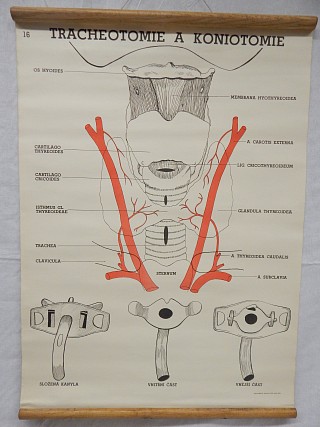 Tracheotomie a koniotomie