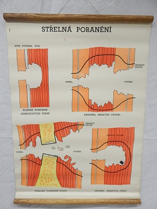 Střelná poranění